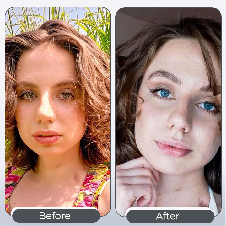 Alisanda™ 𝑺𝒑𝒆𝒄𝒕𝒓𝒂𝑬𝒚𝒆 𝑪𝒐𝒍𝒐𝒓 𝑪𝒉𝒂𝒏𝒈𝒊𝒏𝒈 𝑫𝒓𝒐𝒑𝒔 𝑷𝒓𝒐